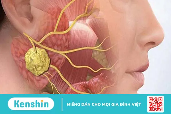 Xương hàm dưới: Giải phẫu, chức năng và một số bệnh liên quan