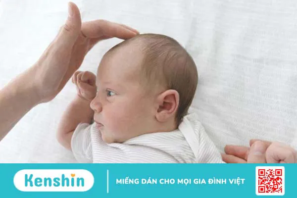 Xương lồi sau đầu ở trẻ sơ sinh có nguy hiểm không?