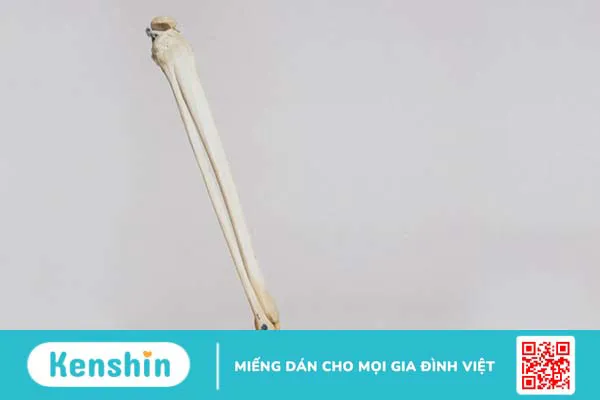 Xương mác là gì? Chức năng và các vấn đề liên quan đến xương mác