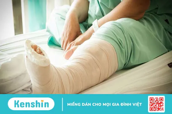 Xương mác là gì? Chức năng và các vấn đề liên quan đến xương mác 3