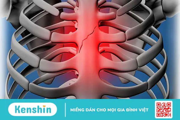 Xương ức là gì? Các bệnh lý liên quan đến xương ức