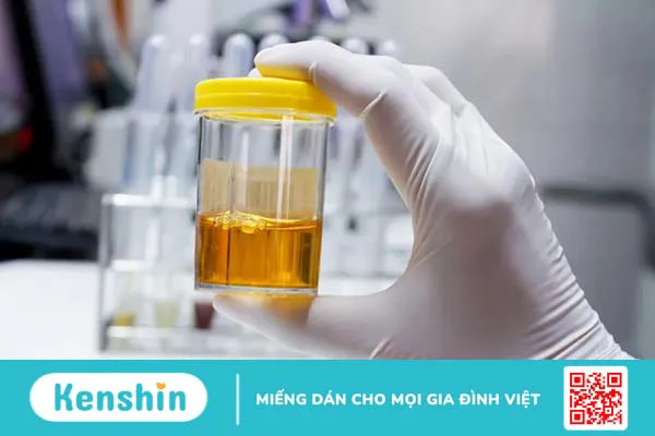 Ý nghĩa các chỉ số xét nghiệm suy thận