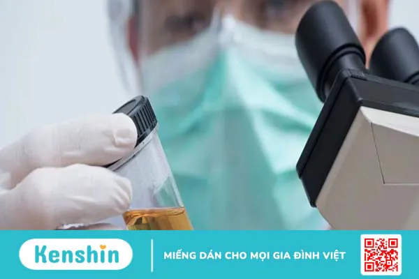 Ý nghĩa của xét nghiệm nitrit trong nước tiểu