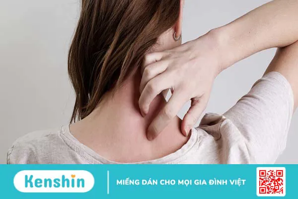 Zona thần kinh bội nhiễm có gây nguy hiểm sức khỏe không?