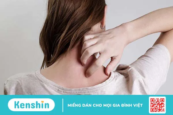 Zona thần kinh bội nhiễm có gây nguy hiểm sức khỏe không?